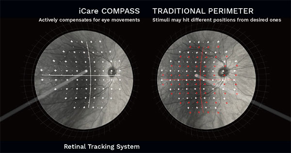 iCare COMPASS Automated Perimeter - Saturn Optical
