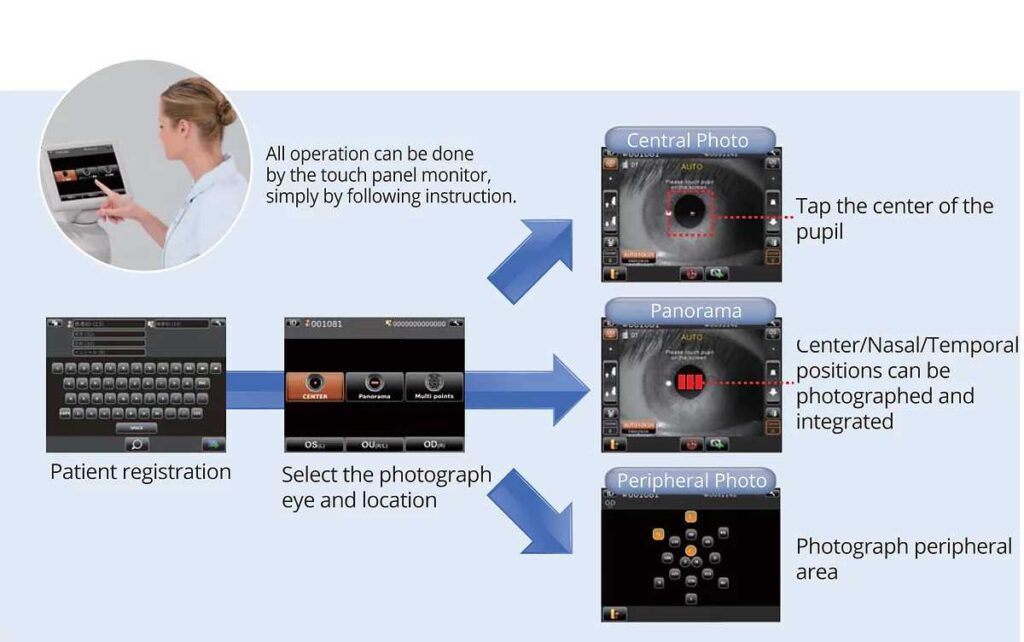 TOPCON SP1P Specular Microscope Saturn Optical