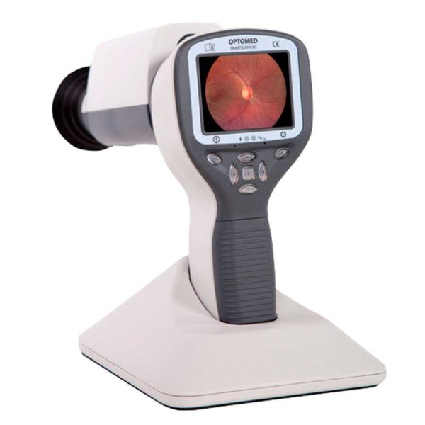 Optomed Smartscope PRO