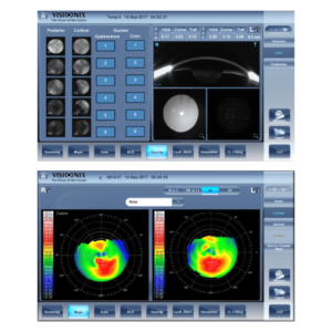 Visionix VX120+ Dry Eye Analyzer | Saturn Optical