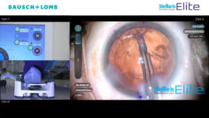 stellaris-elite-retinal Software