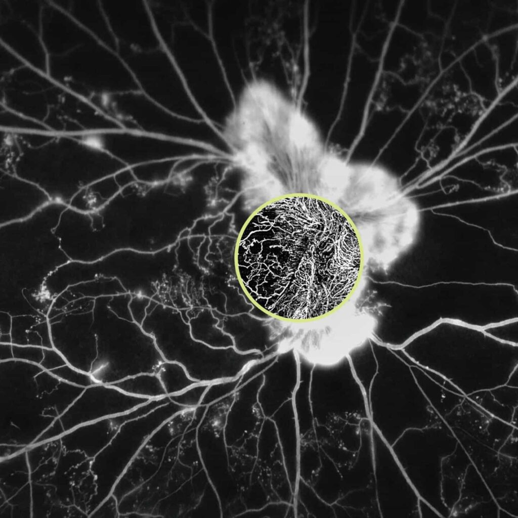 cirrus-angioplex-application-image