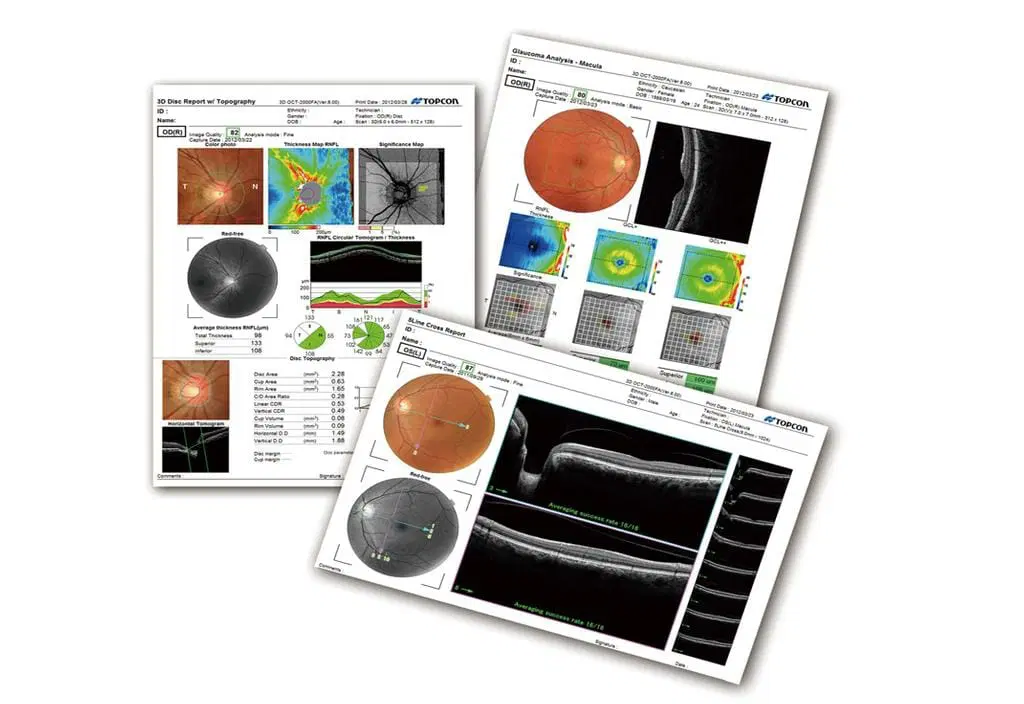 Topcon 3D OCT 1- Maestro 1 
